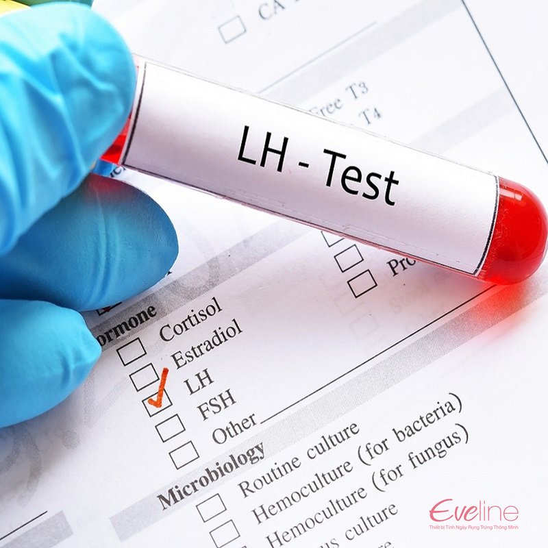 Xét nghiệm chỉ số LH được bác sĩ chỉ định khi kiểm tra sức khoẻ sinh sản