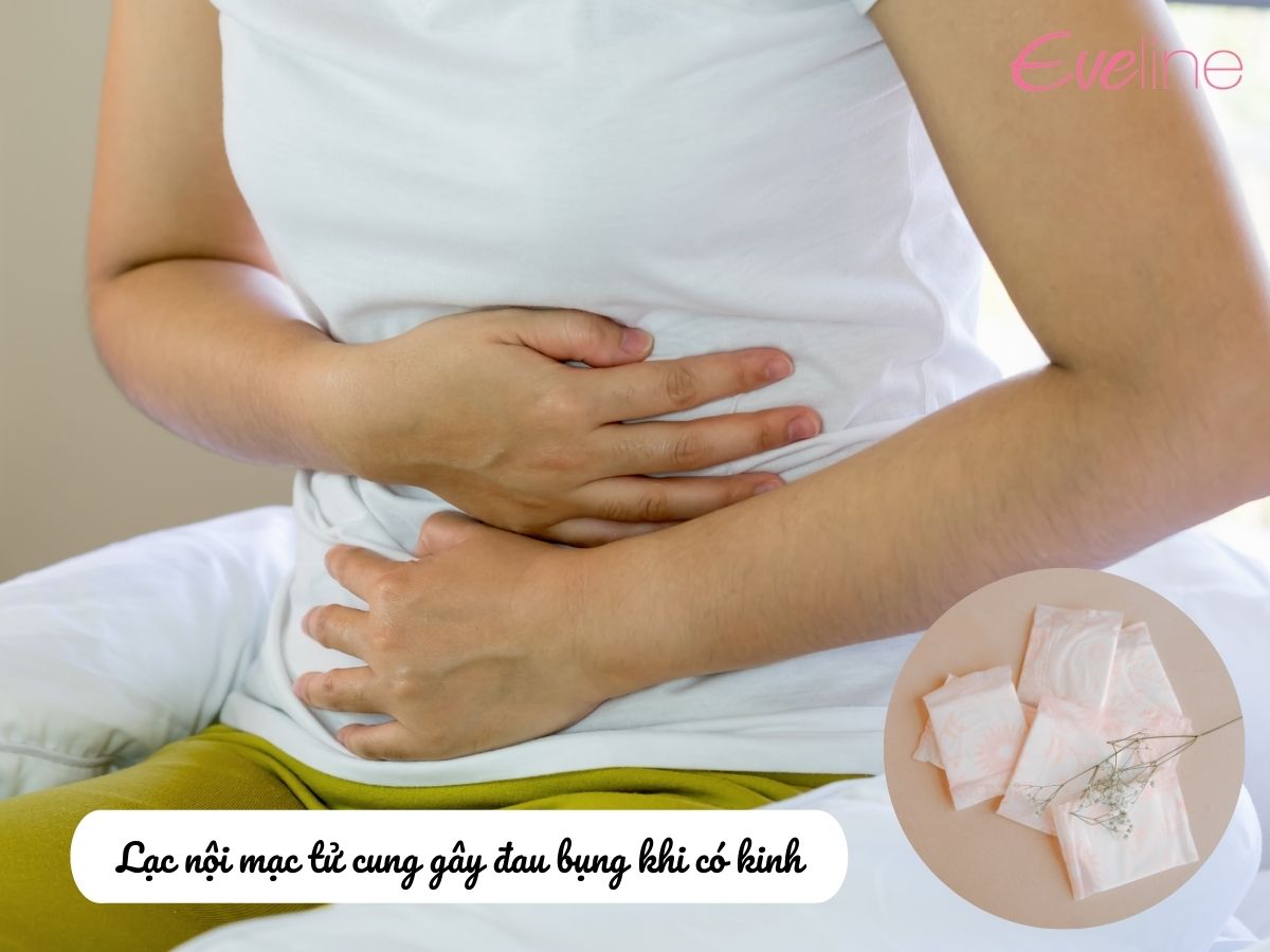 Lạc nội mạc tử cung gây ra tình trạng thống kinh