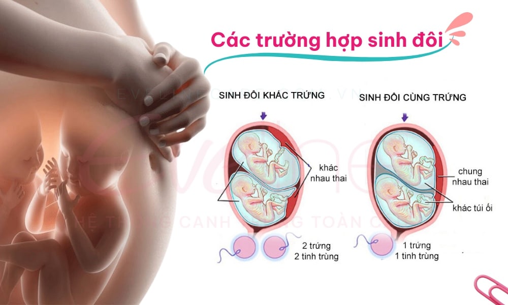Các trường hợp sinh đôi