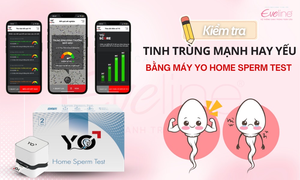 Kiểm tra tinh trùng mạnh hay yếu tạo nhà với YO Home Sperm Test